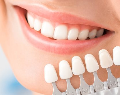 Dental Veneers vs. Teeth Whitening: Which Cosmetic Option Should You Choose?