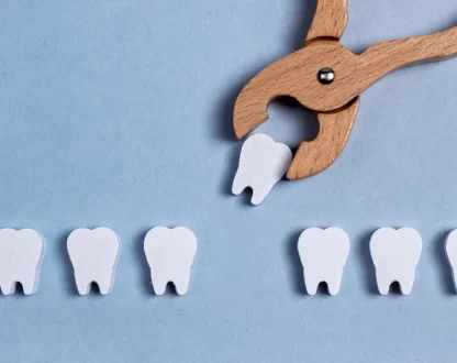 When Can You Eat Normally Again After a Tooth Extraction?